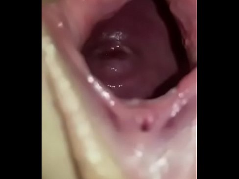 Supernova reccomend cervix view and pussy