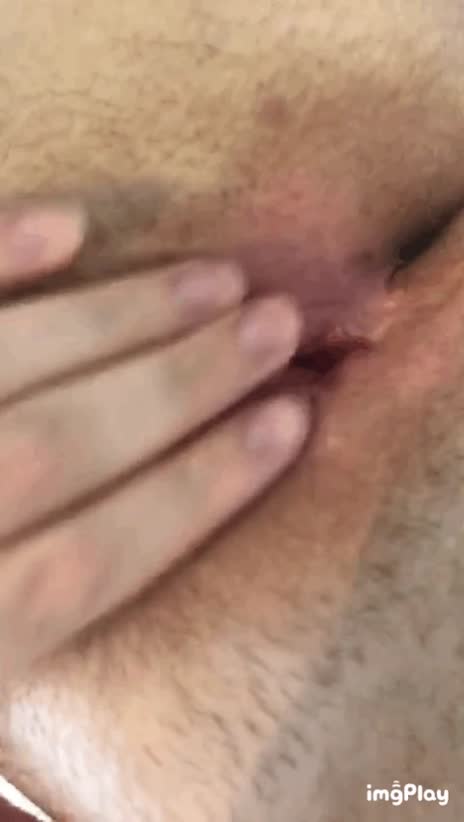 Pale girl with innie vagina