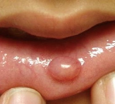 best of Vagina lips Flesh color on bump
