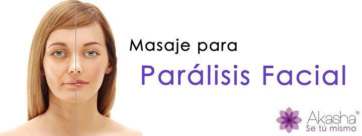 Don reccomend Paralisis facial tratamiento