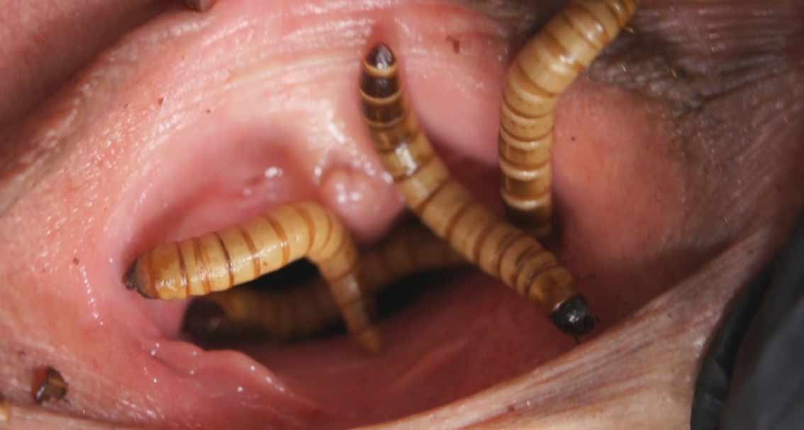 Jackal reccomend Anal parasite worm human