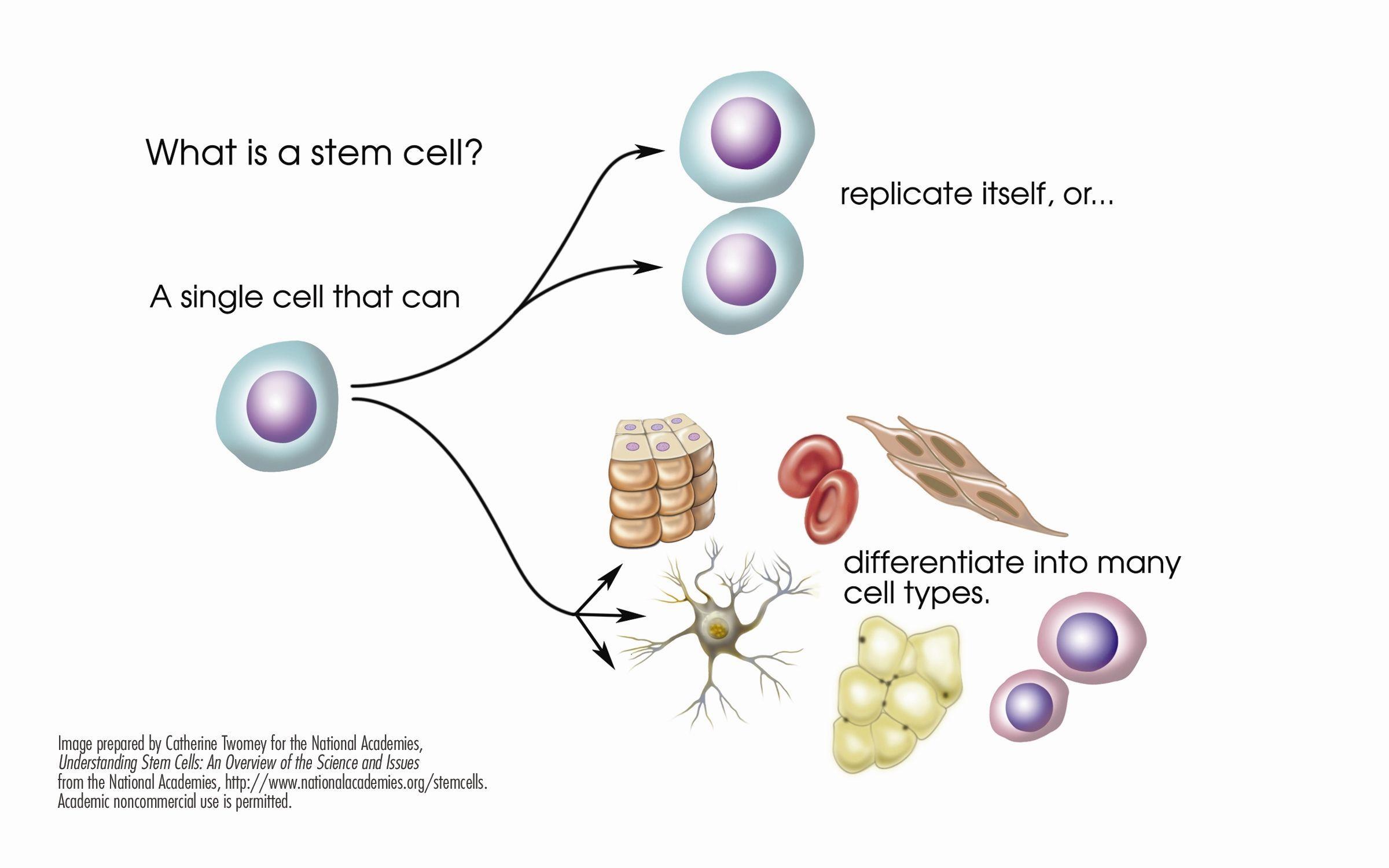 Hurricane reccomend Adult stem cell multiple sclerosis