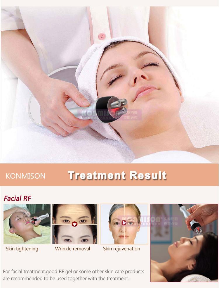 Soda P. reccomend Facial massager fyola ionic Rejuvenate Your Skin