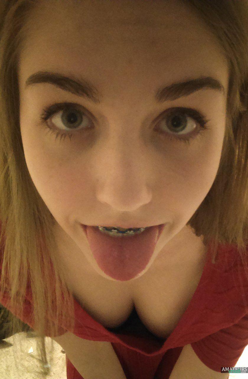 Fendi reccomend tongue braces
